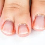 Kerassentials Reviews 2025: Nail Fungus Solution That REALLY Works?