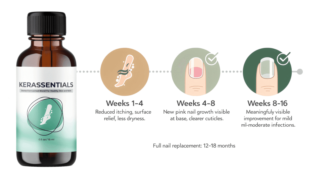 Kerassentials results timeline — realistic nail improvement stages from week 1 through week 16 of consistent daily use